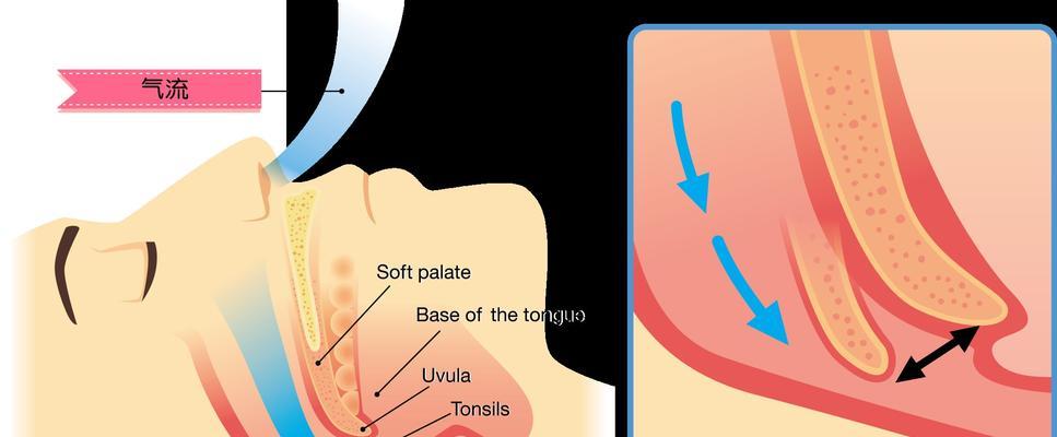 如何解决睡觉打呼噜问题（有效方法帮助您摆脱睡眠中的尴尬）
